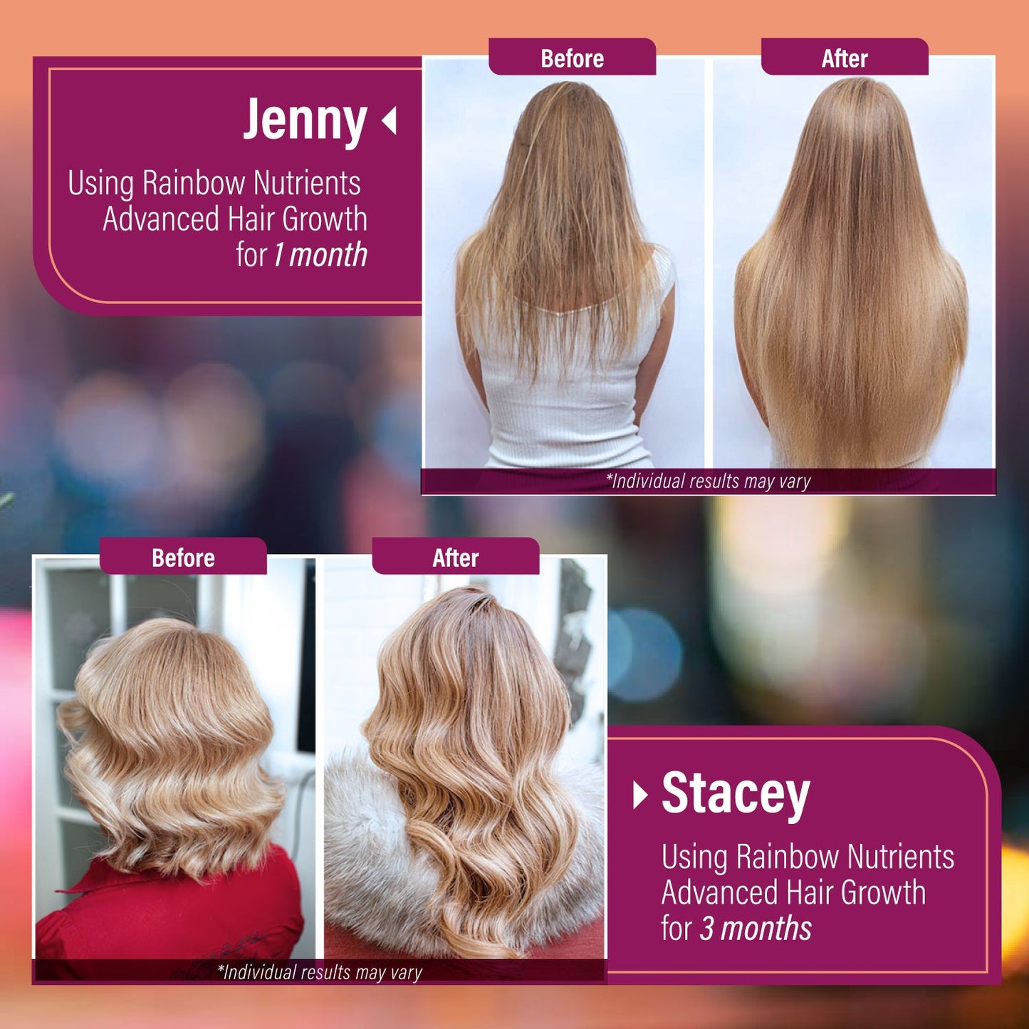 Advanced Hair Growth for Women